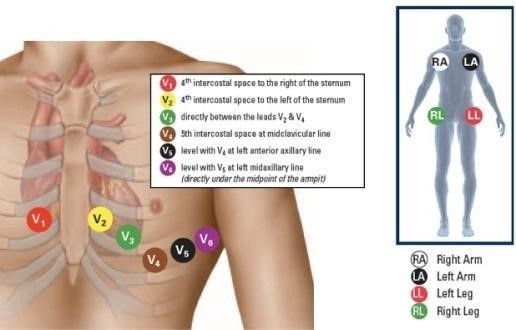 ELECTROCARDIOGRAPHY3