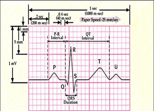 ELECTROCARDIOGRAPHY4